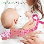 سرطان پستان در شیردهی